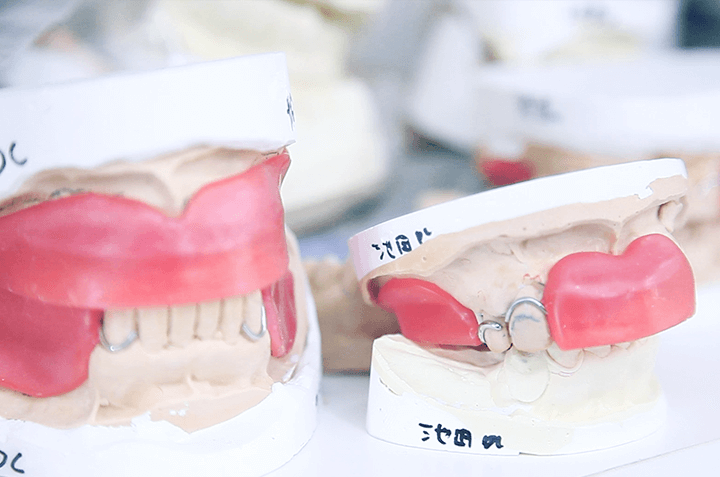 佐賀市の歯医者、佐賀ん歯科・こども歯科で入れ歯治療