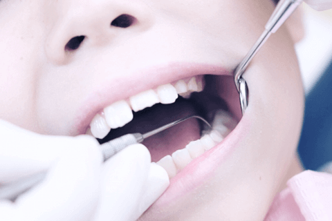 佐賀市の歯医者、佐賀ん歯科・こども歯科で小児歯科