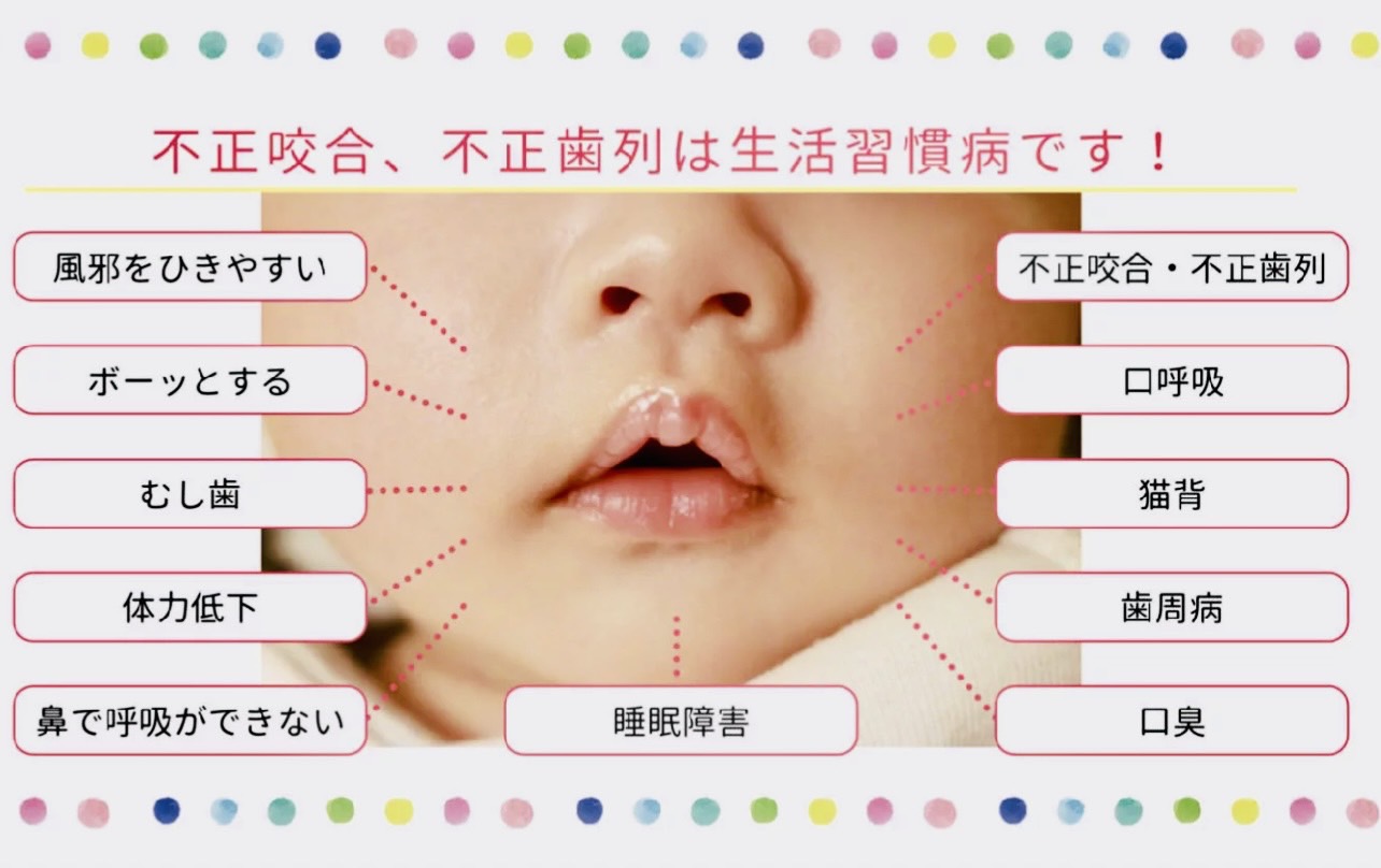 佐賀市の歯医者の赤ちゃん歯科