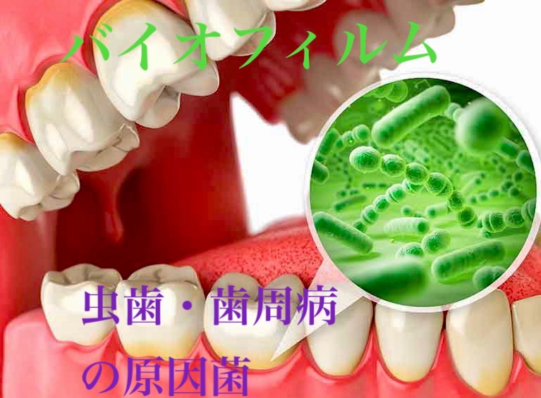 佐賀市の歯医者、佐賀ん歯科・こども歯科の定期検診