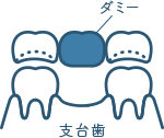 佐賀市の歯医者、佐賀ん歯科・こども歯科の料金表
